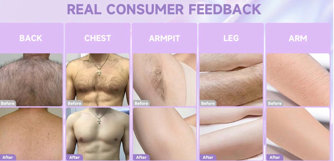 PHOFAY Bikini Pain-Free Hair Removal Cream for Sensitive Skin