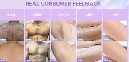PHOFAY Bikini Pain-Free Hair Removal Cream for Sensitive Skin